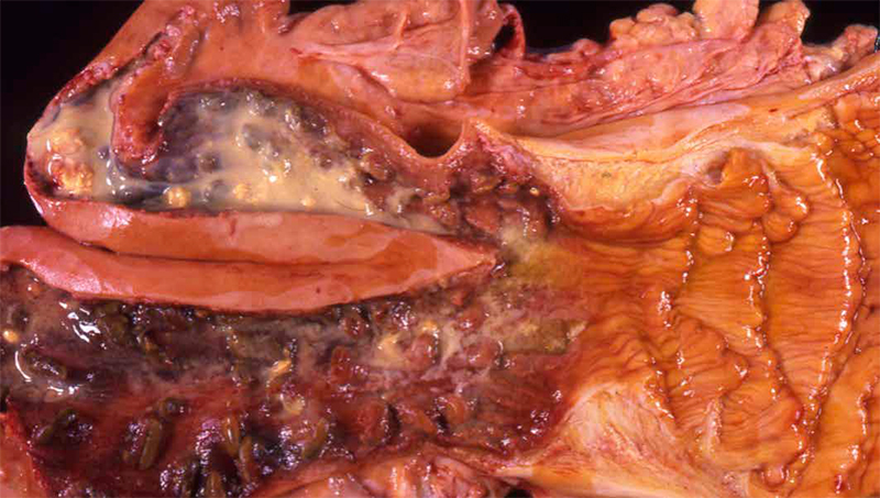La endometritis y su repercusión en la reproducción y eficiencia reproductiva de la vaca endometritis repercusion reproduccion eficiencia reproductiva1