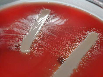 Coriza infecciosa aviar: una amenaza controlable Coriza infecciosa aviar amenaza controlable 1