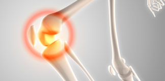 La Osteoartritis: Una Lección de la Clínica Humana para el Profesional de la Veterinaria
