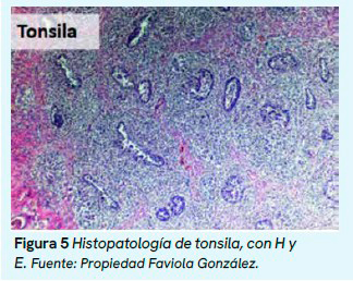 Infección por Streptococcus spp. y Staphylococcus spp. en lechones, y su importancia diagnóstica. Infeccion Streptococcus spp Staphylococcus spp lechones importancia diagnostica3