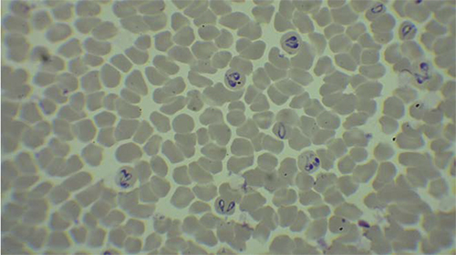Patogenicidad de la picadura-mordedura de la garrapata Rhipicephalus spp. y la susceptibilidad en bovinos Patogenicidad picadura mordedura garrapata Rhipicephalus spp susceptibilidad bovinos 3