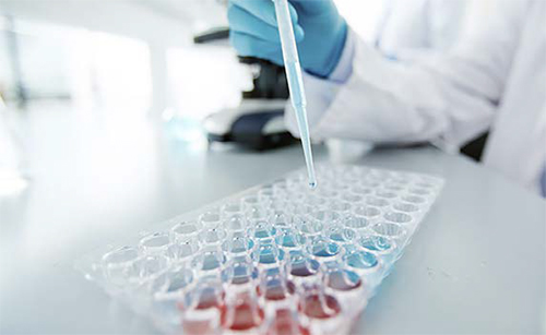 Primer plano sobre metapneumovirus aviar (AMPV) Primer plano metapneumovirus aviar 1